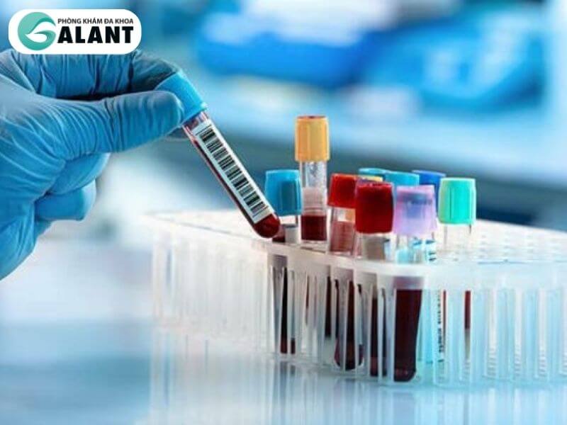 Ảnh 6: Xét nghiệm máu sử dụng phương pháp Elisa Test tìm kháng thể của ấu trùng giun trong huyết thanh bệnh nhân (Nguồn: Internet)
